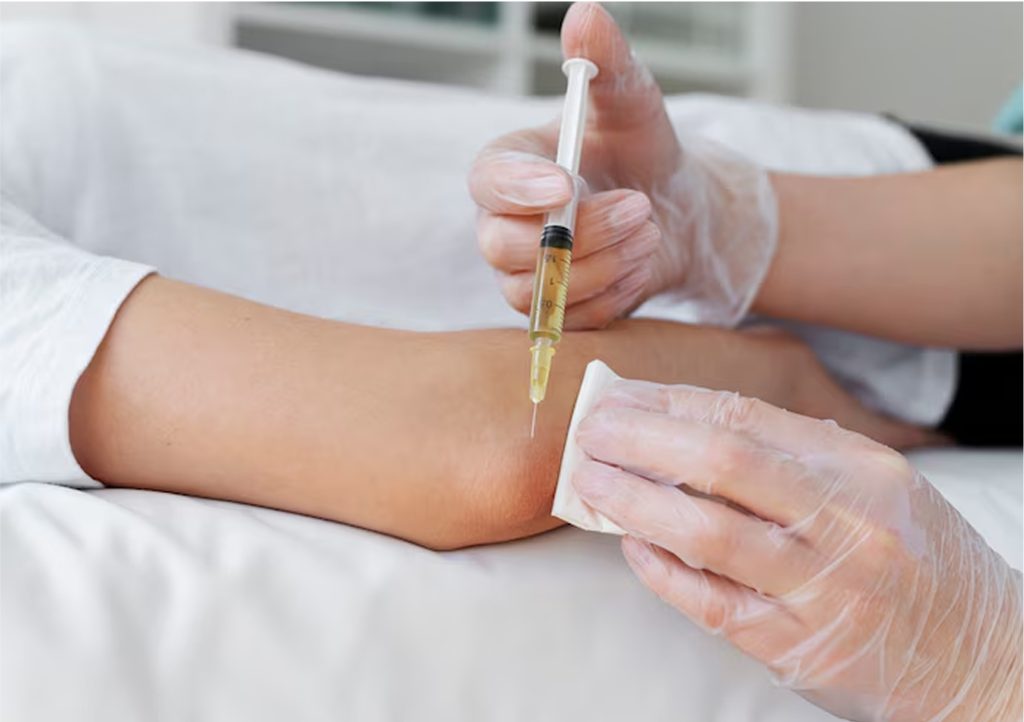 Prolozone Therapy Feature Img